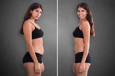 DỊCH VỤ EMS SCULPT TẬN NƠI - E-GO FitS